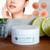 VELUS 痤瘡 美白 保濕護理霜